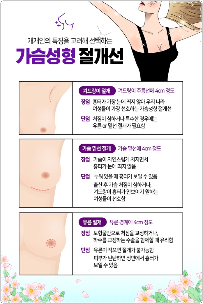 벨라젤마이크로 빈약함에 고민하지마 관련 이미지 9