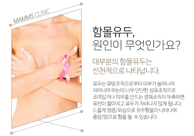 함몰유두교정기 충분하지않다면 관련 이미지 2