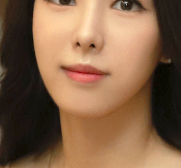 겨드랑이몽우리 라인부터 재발까지 생각하는 솔루션! 관련 이미지 15