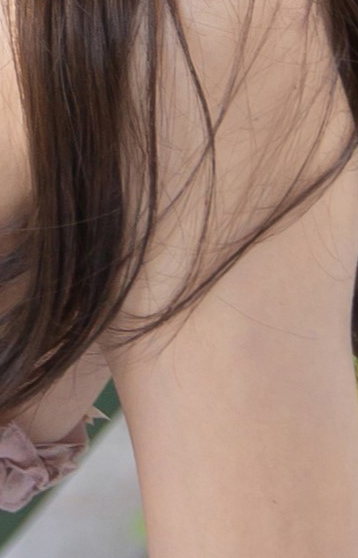 Satisfying Results from Areola Reduction Surgery image 22