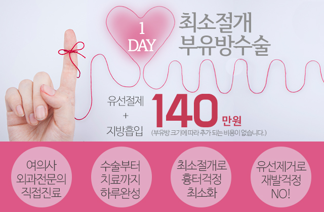 겨드랑이멍울 혹시나도부유방? 관련 이미지 3
