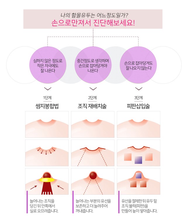 짧은유두 어려움이있다면 관련 이미지 3