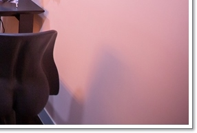 What You Should Know Before Breast Ptosis Surgery image 51