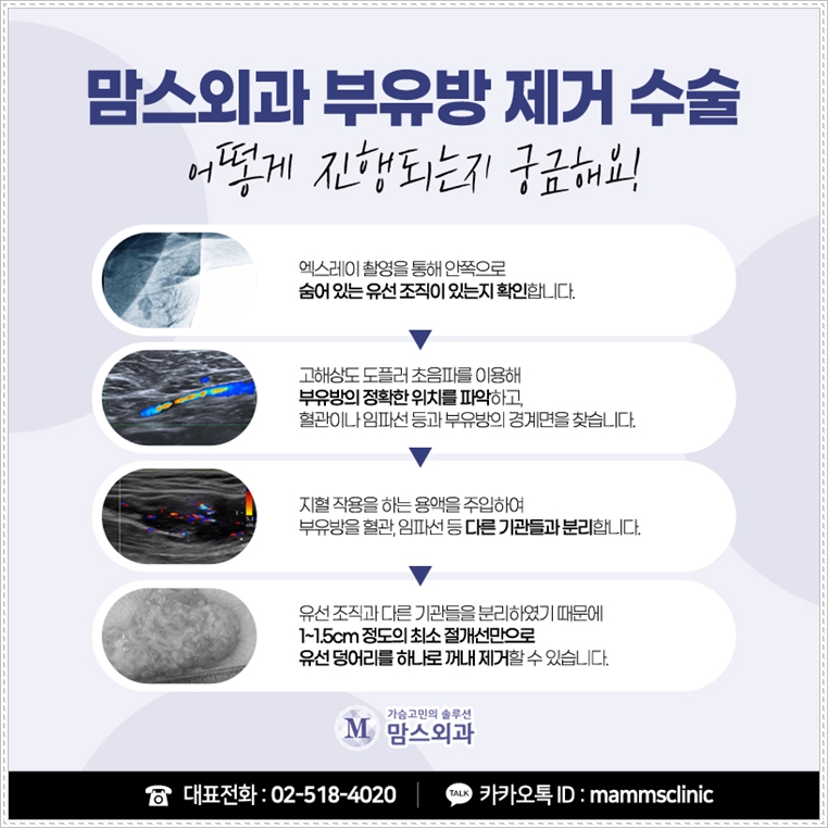 방치해선 안되는 겨드랑이 임파선 고민을! 관련 이미지 7