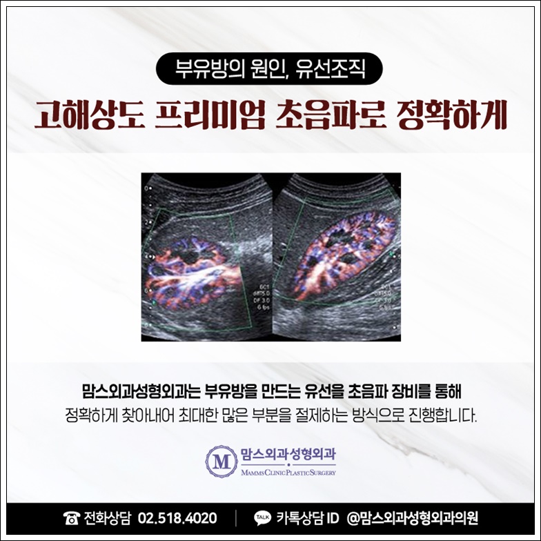 부유방제거비용 중요하지만 관련 이미지 9