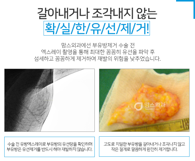 부유방원인 근본적인해결 관련 이미지 4