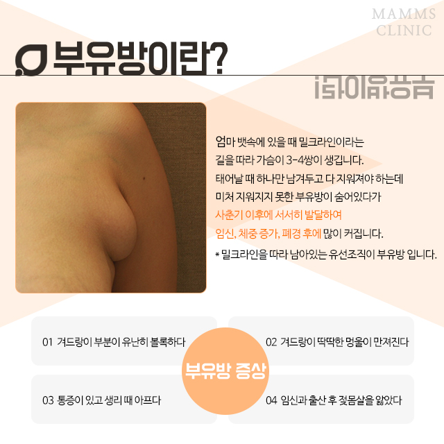 부유방제거수술 특별함을 관련 이미지 2