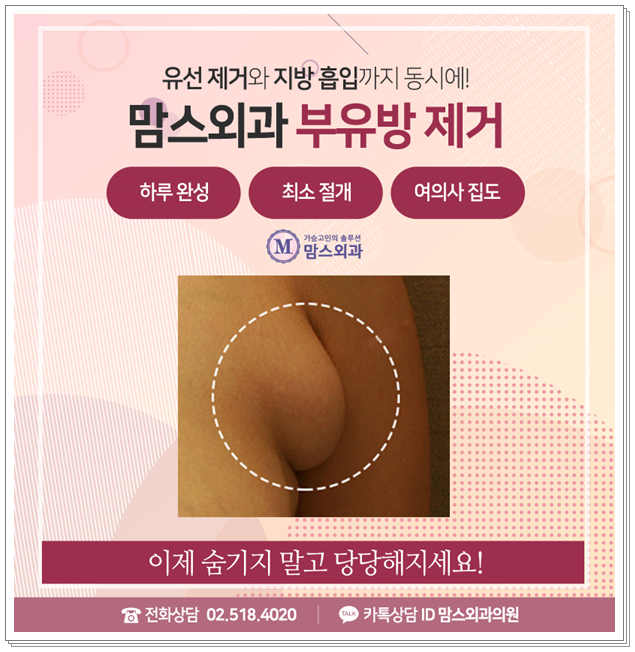부유방빼기 하루에 가능 했다니 관련 이미지 12