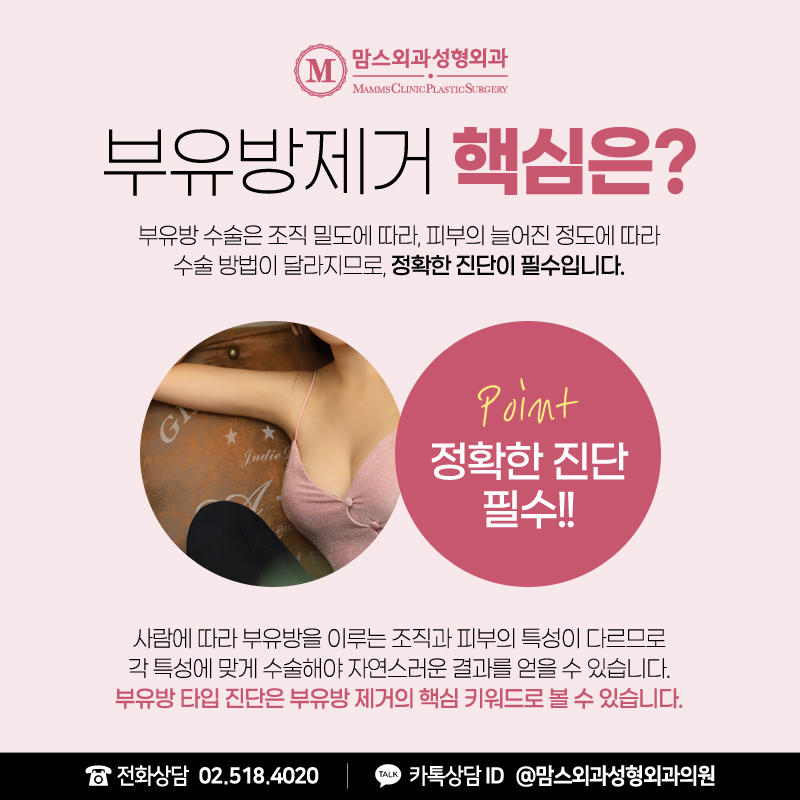 When Is Axillary Breast Tissue Liposuction Possible? image 9