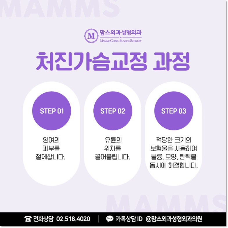 처진가슴교정 당당함을 담다 관련 이미지 10