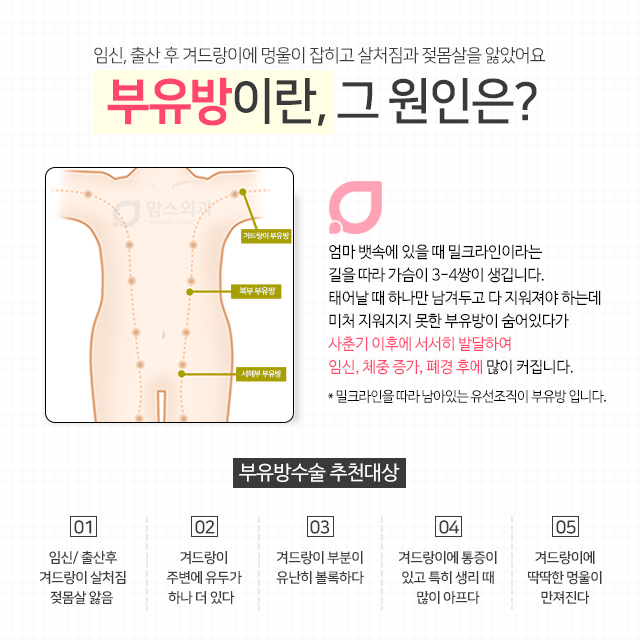 임산부부유방 속앓이는그만 관련 이미지 2