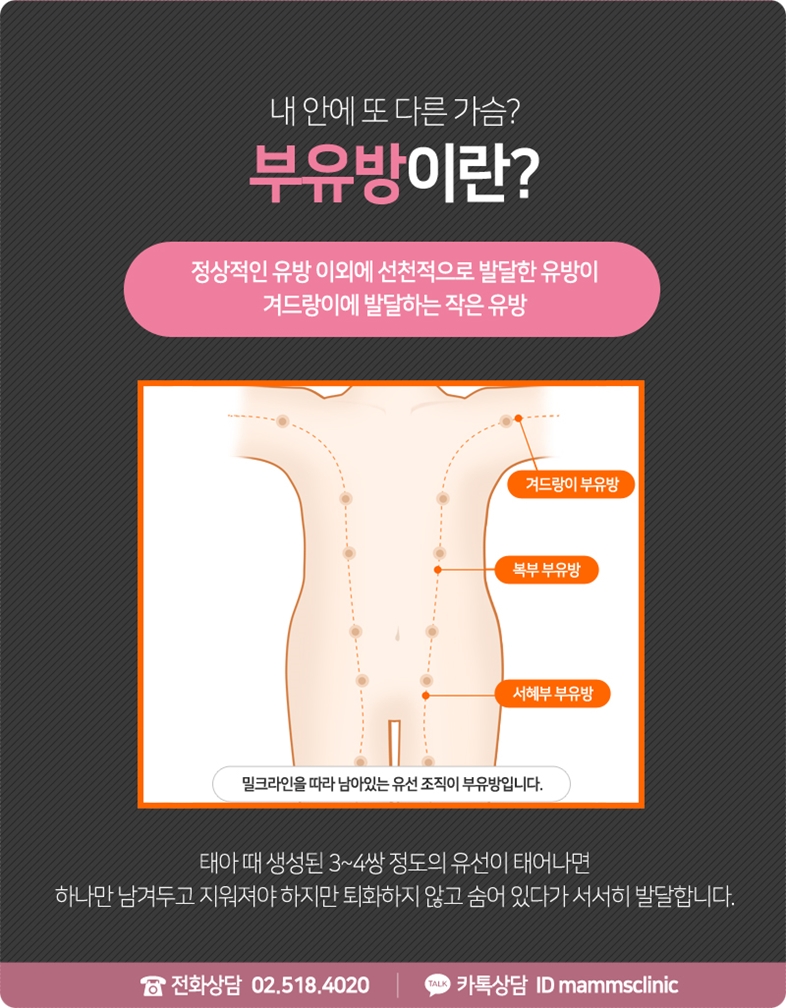 겨드랑이살빼기 쉽게 안 빠진다면 관련 이미지 3