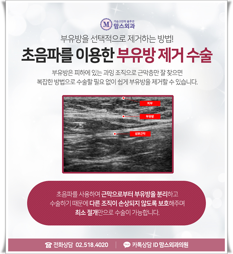 부유방수술 부담이 됐다면! 관련 이미지 7