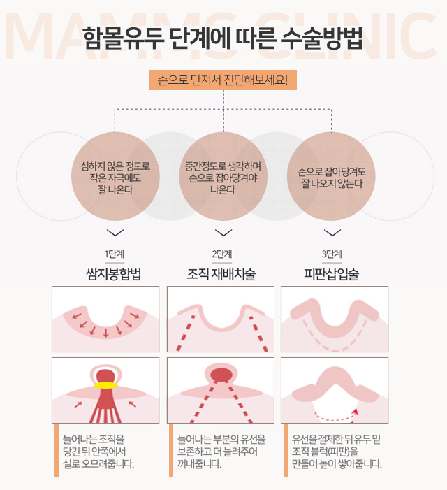 함몰유두교정술 찾고있나요 관련 이미지 5