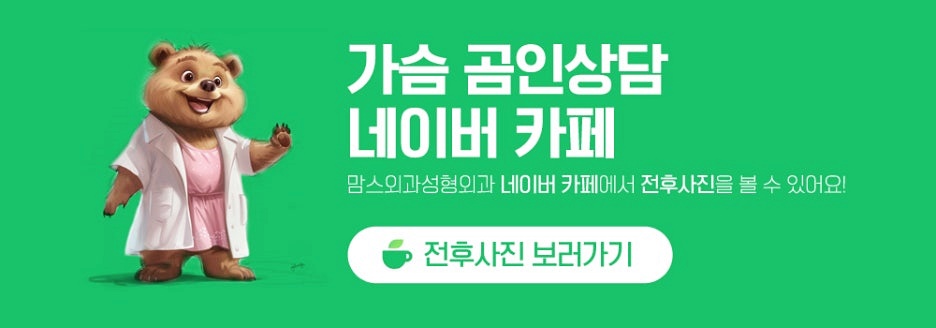 겨드랑이멍울병원 부유방, 유선만 제거하면 끝일까요? 관련 이미지 5