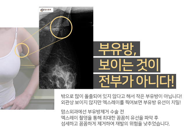 겨드랑이아래통증 왜이런걸까 관련 이미지 3