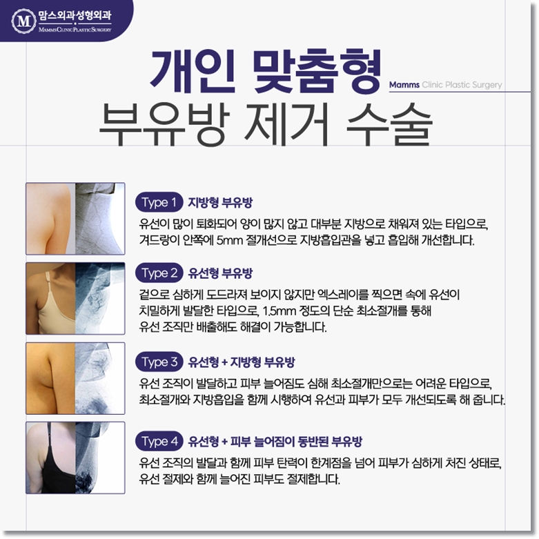 Identify the Cause of Armpit Pain image 6