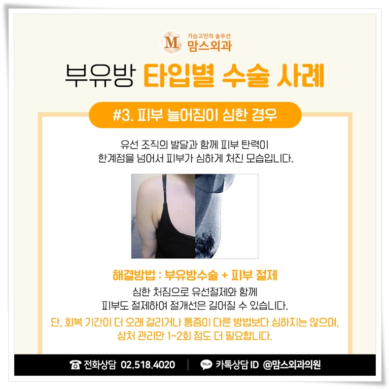 겨드랑이멍울통증 신경쓰인다면 관련 이미지 7