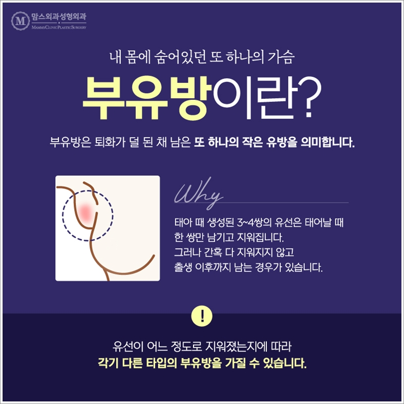 겨드랑이지방흡입 자꾸만 생각이 난다면? 관련 이미지 2
