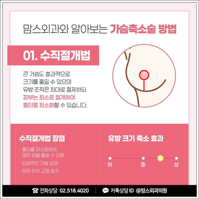 가슴축소술 흉터, 심하지 않게 관련 이미지 6