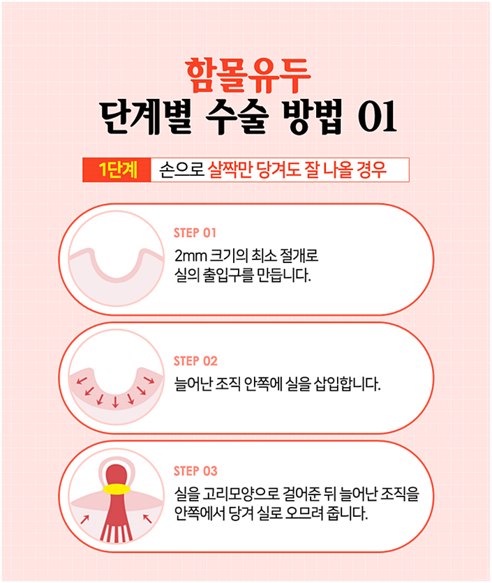 유두성형 더 당당해질 수 있지 관련 이미지 5