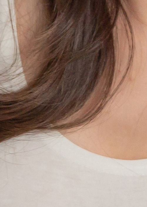 겨드랑이유선 깨끗하게 관련 이미지 17