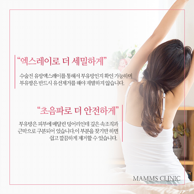 겨드랑이멍울 혹시나도 관련 이미지 5