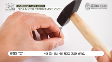 가슴축소 수술 후 흉터, 무조건 짧은 절개선이 정답일까? 관련 이미지 3