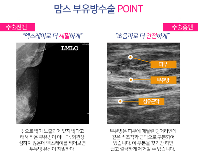 겨드랑이몽우리 큰일아니죠 관련 이미지 4