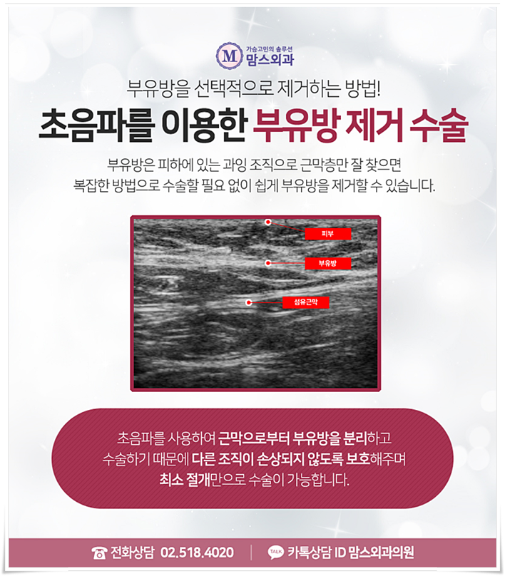 부유방제거 걱정만 했었는데 관련 이미지 6