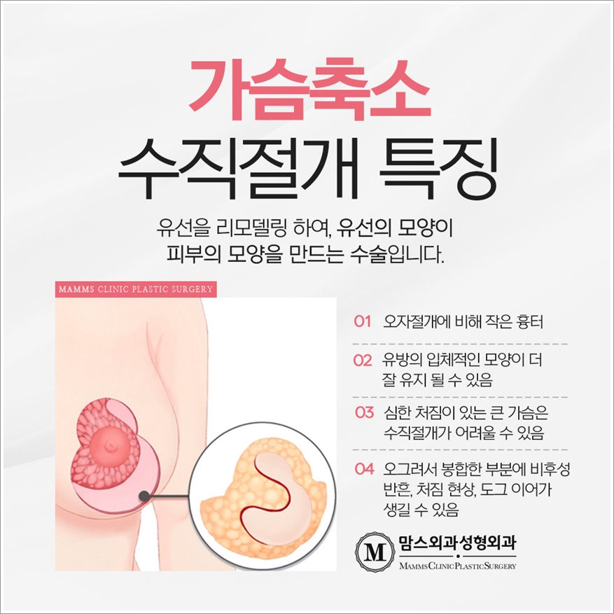 가슴축소술 든든한 마음으로 관련 이미지 5