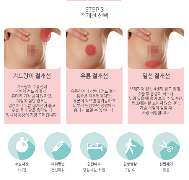 가슴확대수술후기 따져보셨나요? 관련 이미지 4