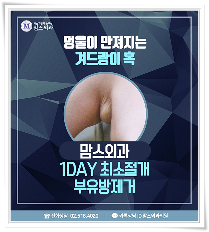 부유두 어딘가 이상해 보여 관련 이미지 1
