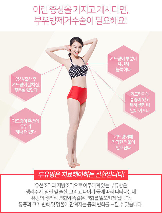 부유방제거수술 믿을수있는곳에서 관련 이미지 3