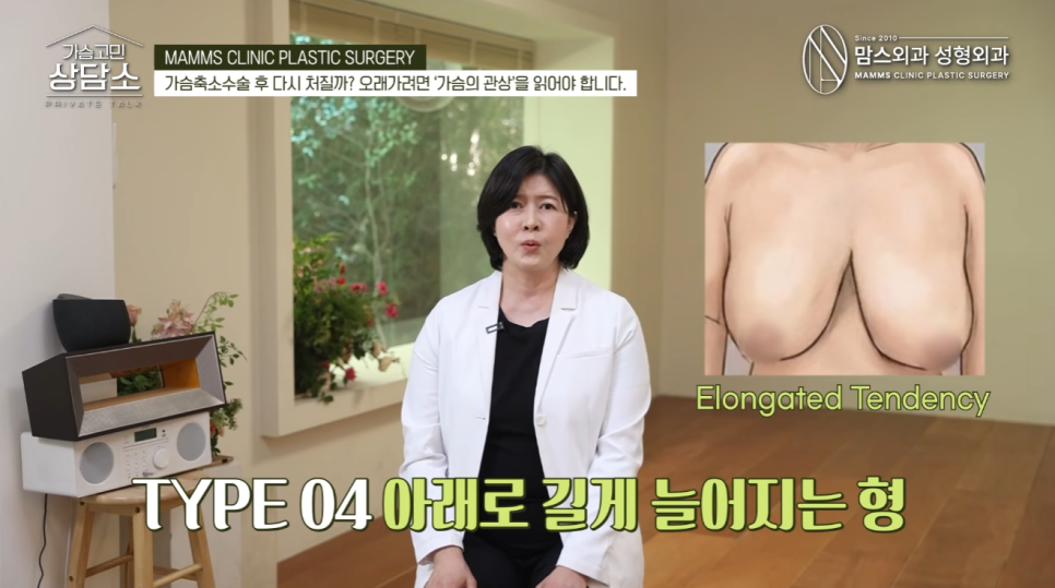 가슴축소수술 후 다시 처질까? 수술 후 오래 유지되는 핵심 관련 이미지 11