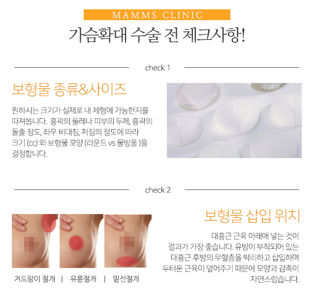 가슴확대비용 합리적으로 관련 이미지 3