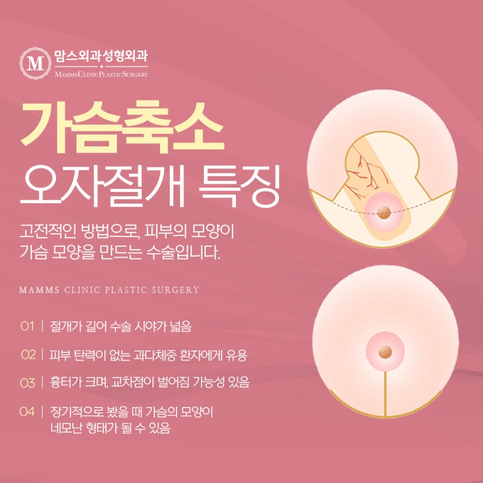 가슴축소흉터 포괄적인 사후관리가 있는 맘스외과성형외과 관련 이미지 3