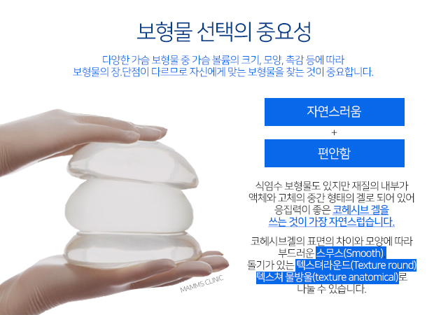 가슴확대수술가격 모든게맘에들어 관련 이미지 3