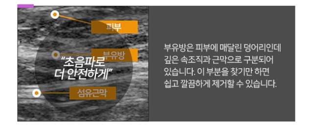 부유방원인 정확하게알아봐요 관련 이미지 6