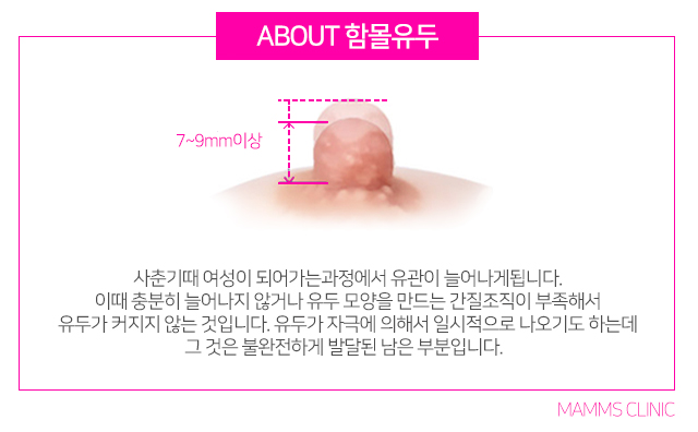 함몰유두전후 달라진내모습 관련 이미지 2