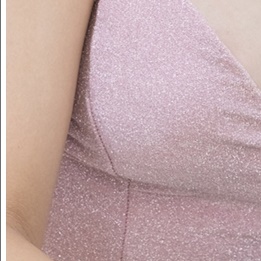 Breast Reduction Surgery from a Different Perspective image 19