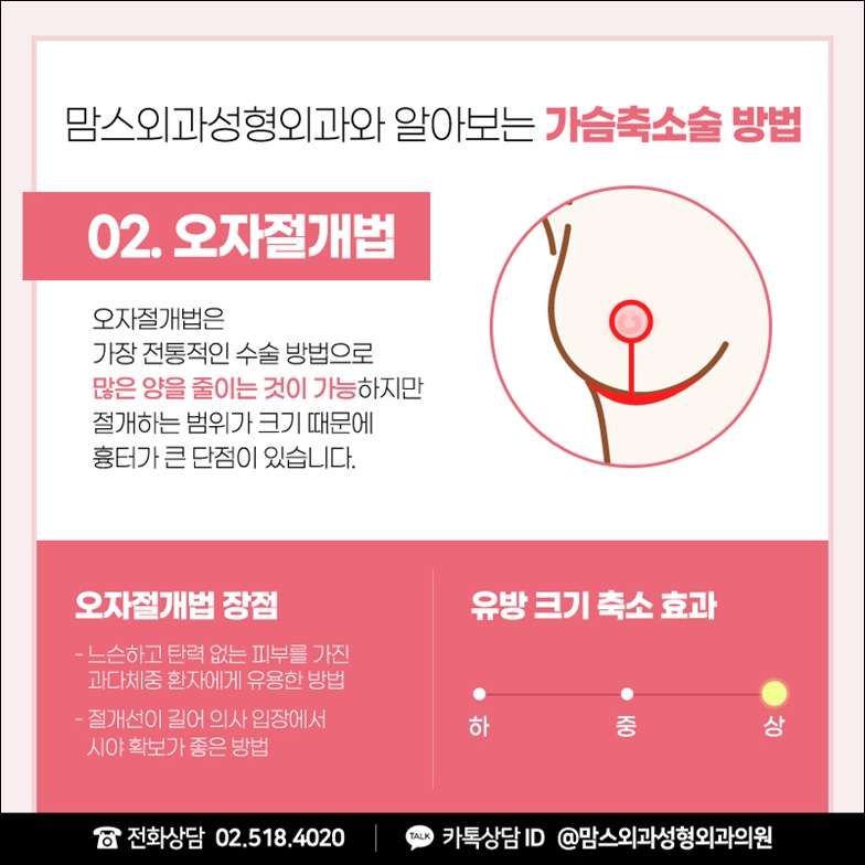 거대유방축소수술 잘못된 편견 관련 이미지 6