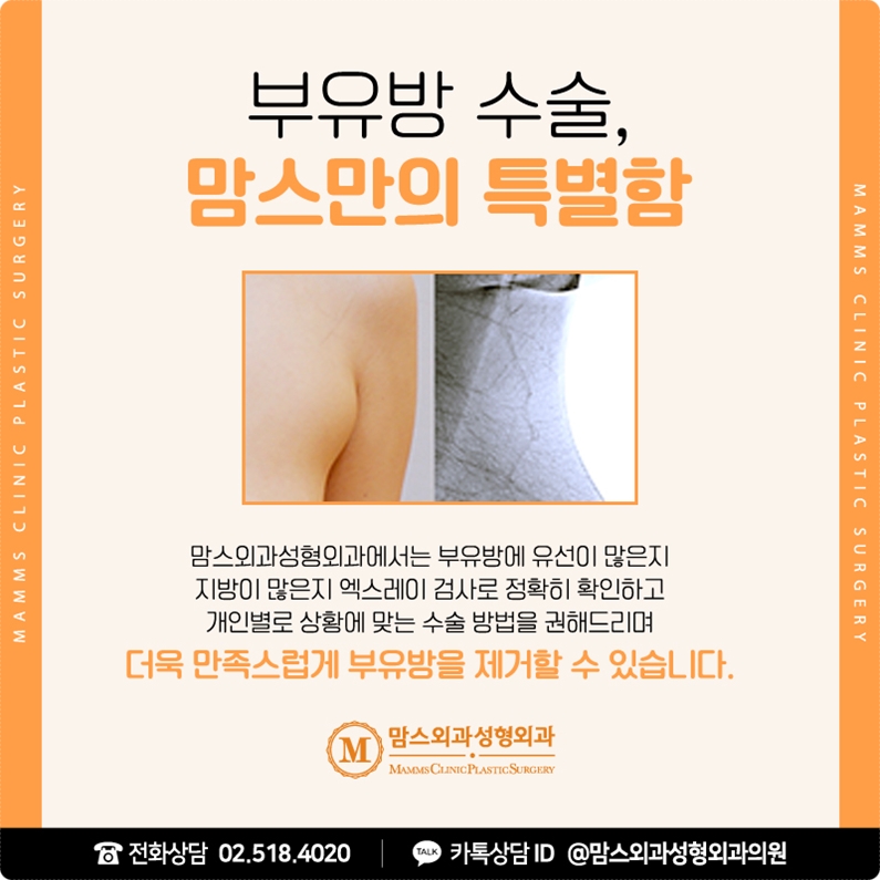 부유방 지방분해주사 원하는 모습이 될까? 관련 이미지 6