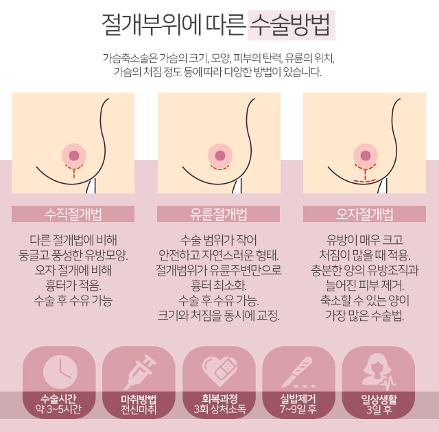 출산후처진가슴 아름다움회복 관련 이미지 4