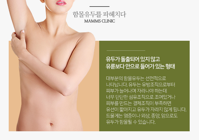 강남함몰유두수술 단계에맞게 관련 이미지 2