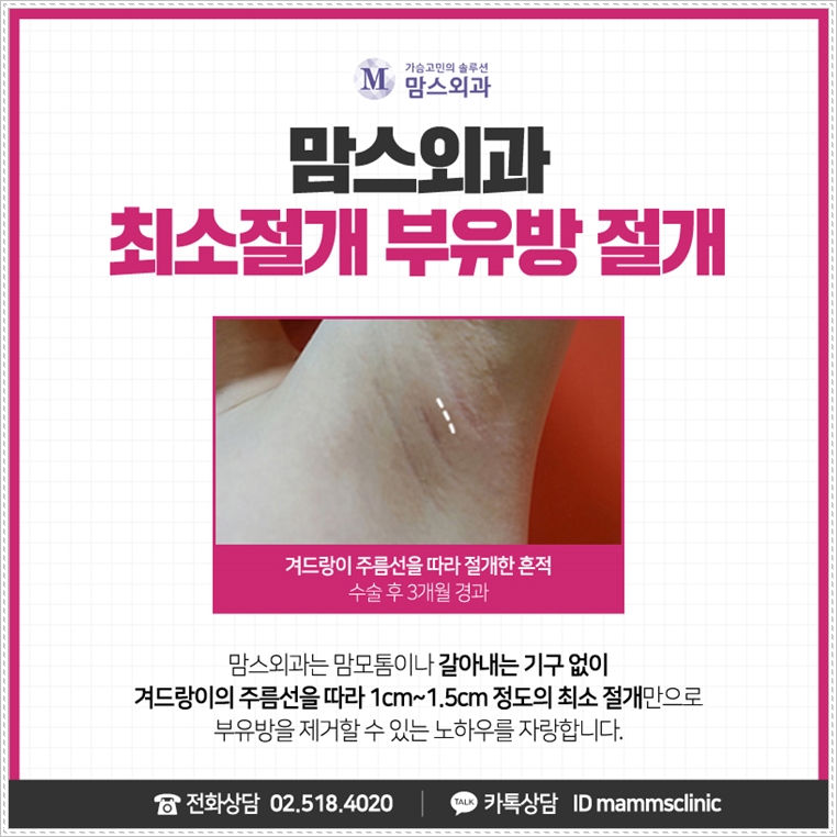 방치해선 안되는 겨드랑이 임파선 고민을! 관련 이미지 5