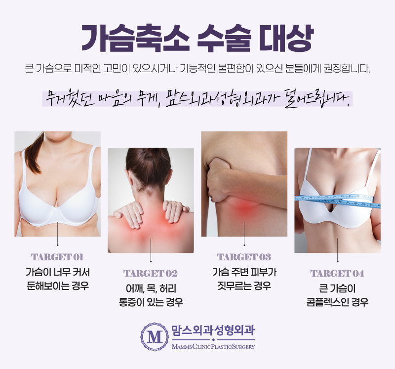 가슴축소술 유방외과와 성형외과 전문의 협진으로 더 효과적이게! 관련 이미지 5