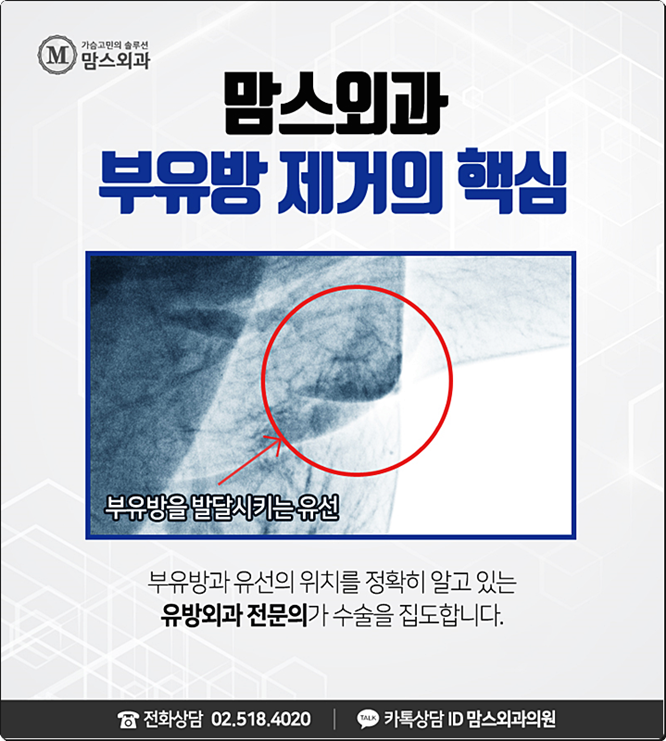 부유방통증 느껴지고 있다면 관련 이미지 3