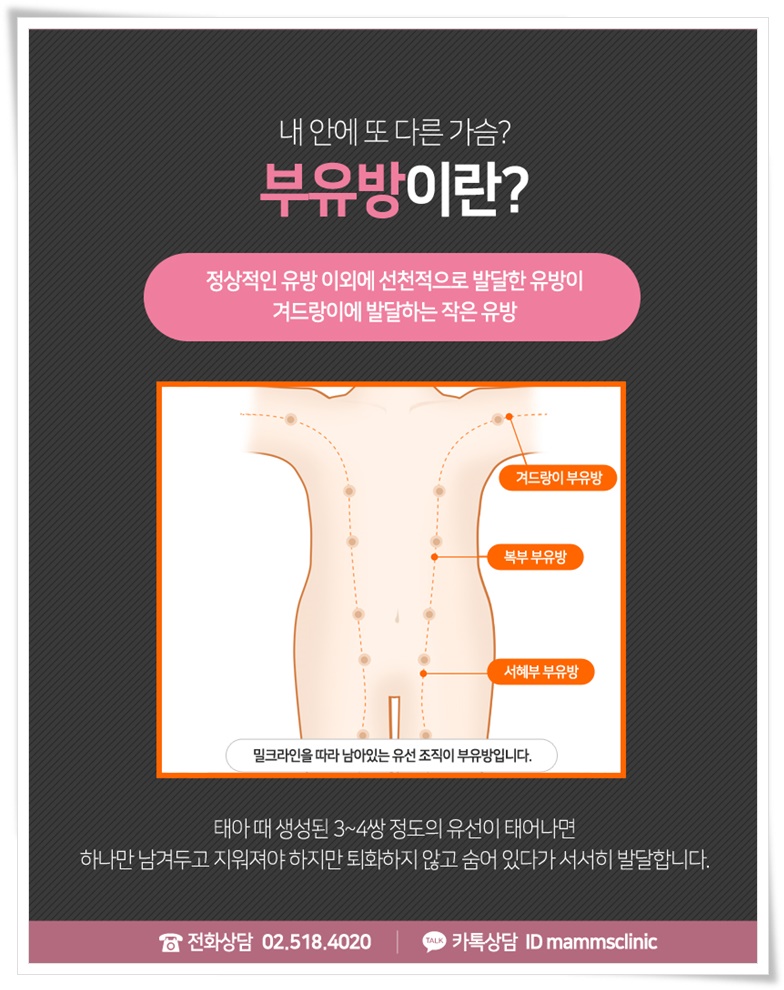 부유방제거로 삶의 질을 위해 관련 이미지 2