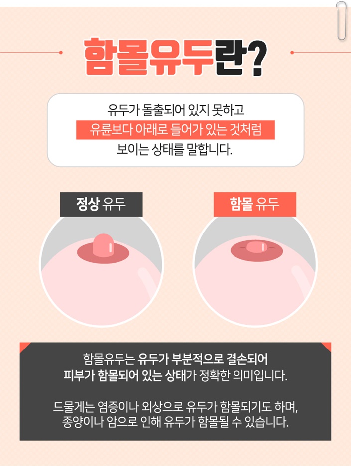 함몰유두교정 답을 찾으세요? 관련 이미지 2